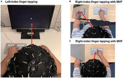 The Effects of Priming Intermittent Theta Burst Stimulation on Movement-Related and Mirror Visual Feedback-Induced Sensorimotor Desynchronization